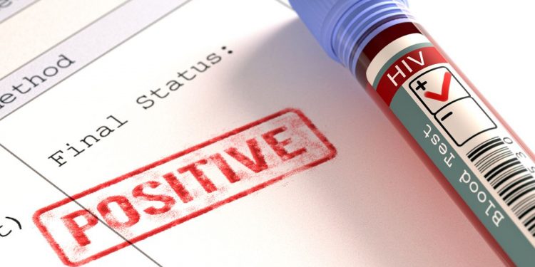HIV Positive odisha