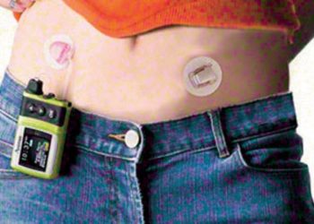 Artificial pancreas system