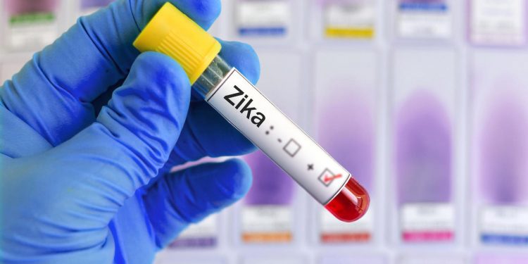 Zika virus