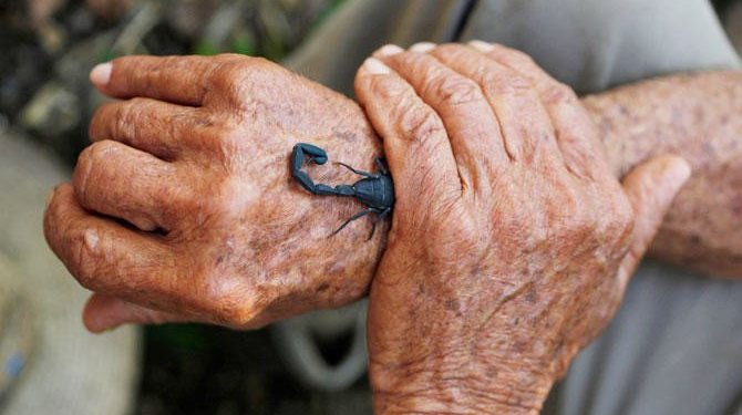 Farmer Pepe Casanas is stung by a scorpion in Los Palacious, Cuba December 5, 2018. (REUTERS)