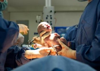 Odisha orders audit of all caesarean delivery cases in the state