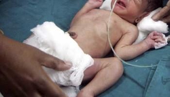 Amritsar's miracle baby boy