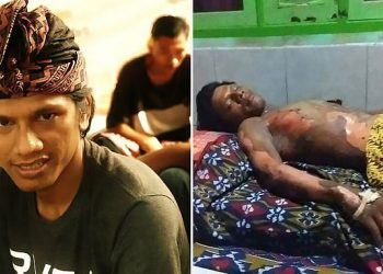 Burned alive: Dedi Purnama, 26, died two days after his wife, 25, poured petrol on him and set him on fire during a fight about his mobile phone in their home in Indonesian
