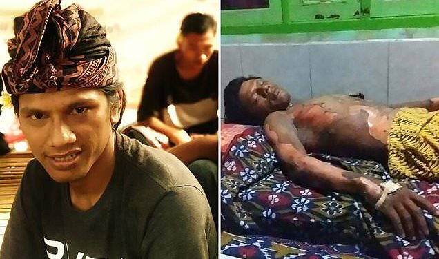 Burned alive: Dedi Purnama, 26, died two days after his wife, 25, poured petrol on him and set him on fire during a fight about his mobile phone in their home in Indonesian