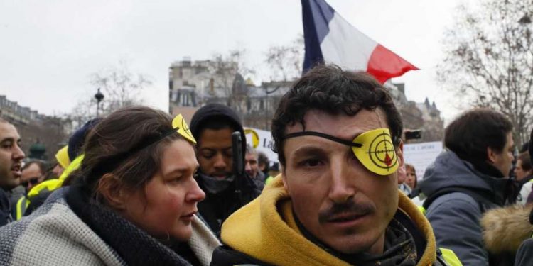 A wounded protester attends the yellow vests demonstration Saturday, Feb. 2, 2019 (AP)