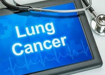 lung cancer