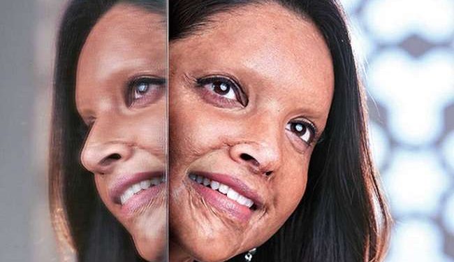 Deepika shares her first look from 'Chhapaak'