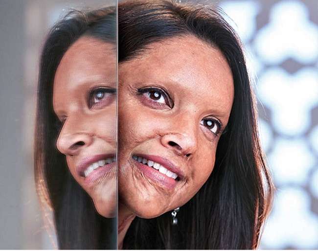 Deepika shares her first look from 'Chhapaak'