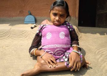 Poverty stands between treatment and a physically challenged daughter, parents in distress