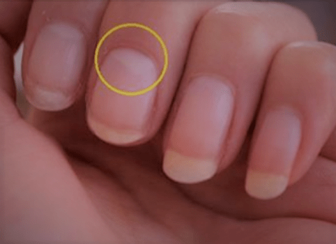 How to get a half-moon (Lunula) back on my nails - Quora