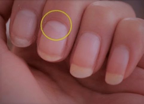 Fingernail Moons Reveal Secrets About Your Health | LittleThings.com