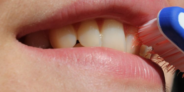 Human teeth is made up of three layers -- the outer tooth enamel, an underlying dentin layer and connective tissue that binds the roots to the gum.