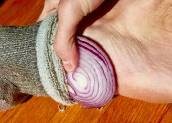 Put onion slices in socks under your feet overnight to get these benefits
