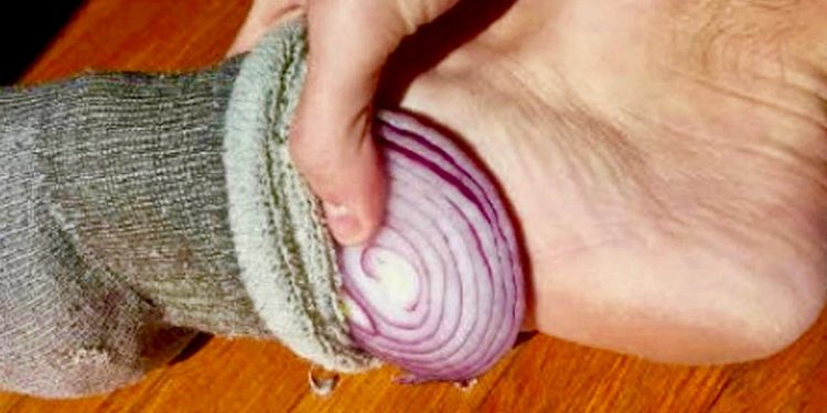 Put onion slices in socks under your feet overnight to get these benefits