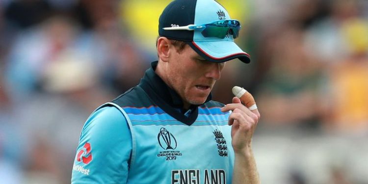 England, who came into the World Cup as hot favourites, Tuesday suffered a 64-run defeat at the hands of arch-rivals Australia at the Lord's.