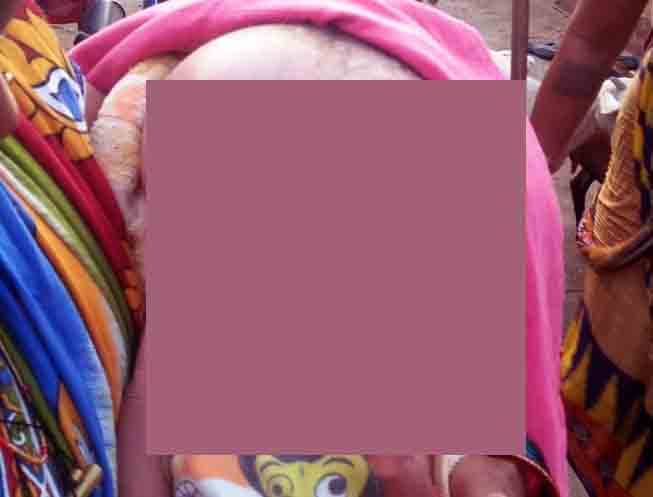 Baby with abnormal head growth awaits govt help