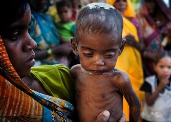 728 malnourished kids recorded in Nayagarh
