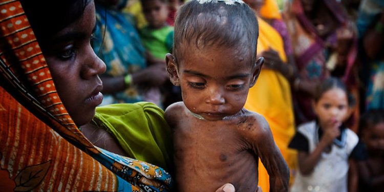 728 malnourished kids recorded in Nayagarh