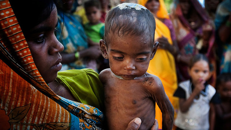 728 malnourished kids recorded in Nayagarh - OrissaPOST