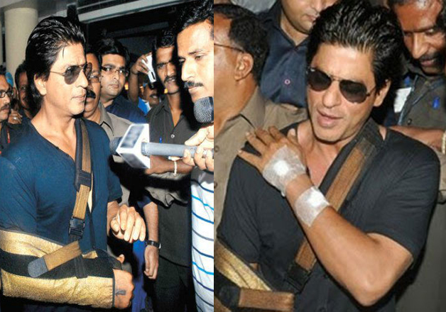 These actors suffered severe injuries while shooting