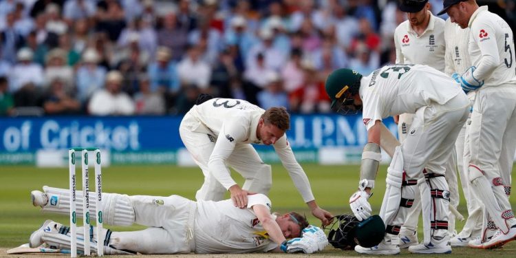 Smith was felled by a Jofra Archer bouncer Saturday.