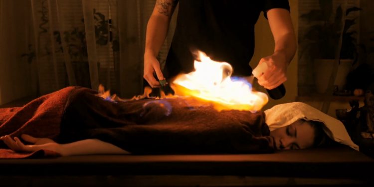 Here disease is cured by setting the patient’s body on fire