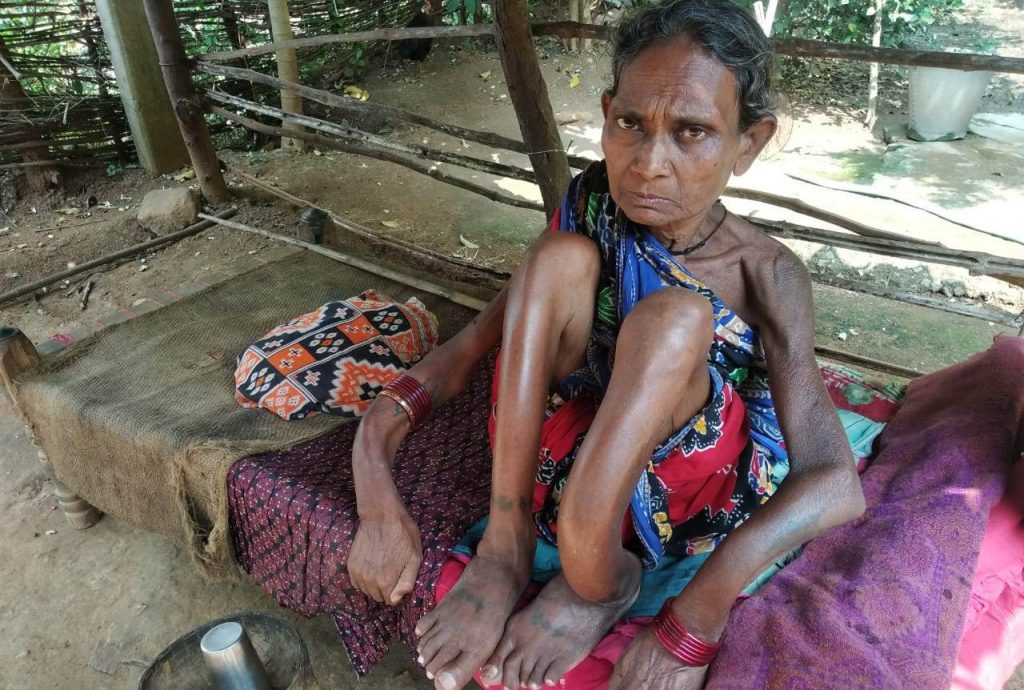 Physically challenged woman seeks government help