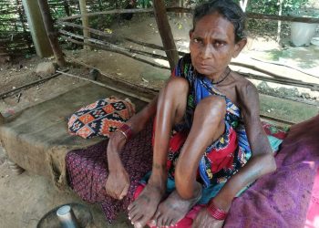 Physically challenged woman seeks government help