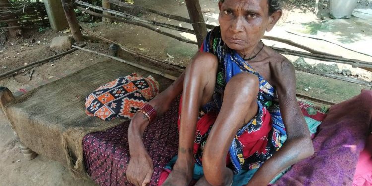 Physically challenged woman seeks government help