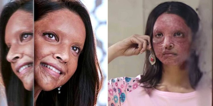 'Chhapaak' taken to Bombay HC over writing credit