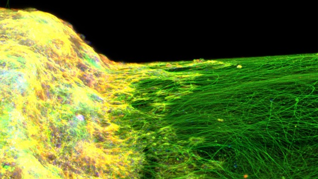 First 3D neural tissue model developed in lab