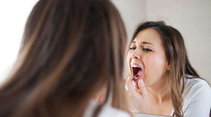 Sugary diet can promote serious gum infections