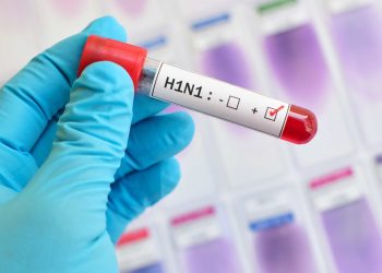 State reports first swine flu case of the year