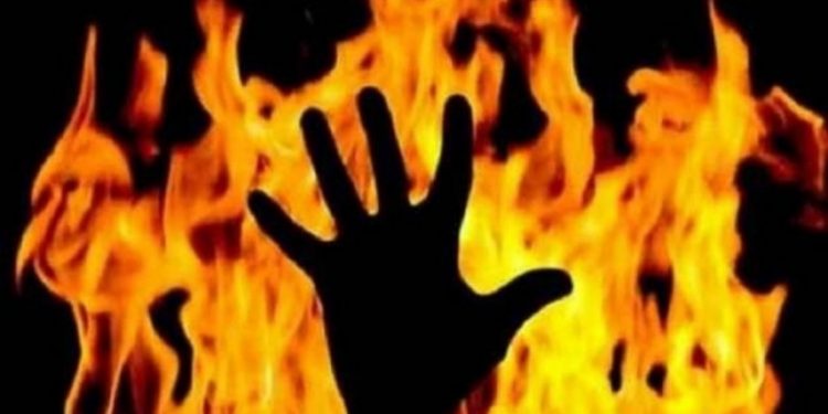 Minor brother, sister suffer burns, condition critical