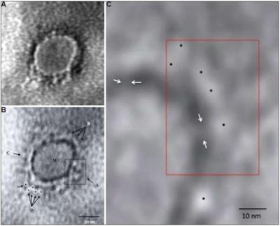 First images of Covid-19 virus in India released