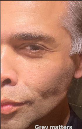 Karan Johar flaunts his greys on social media; see pic