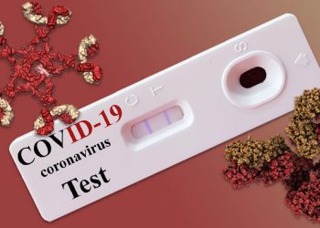 Antigen test