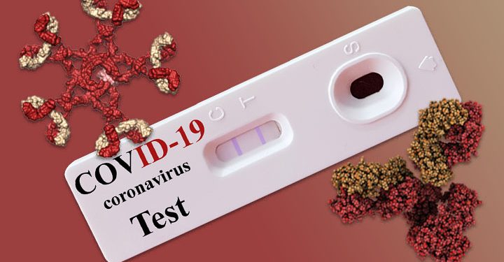 Antigen test