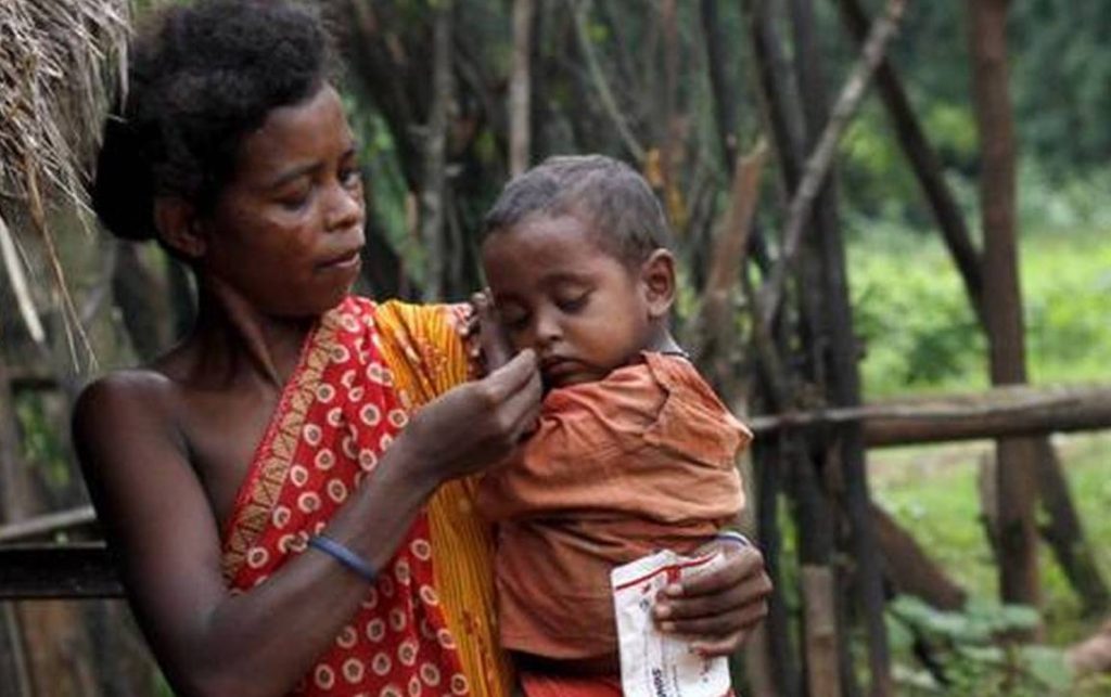 Malnutrition among kids on rise in Mayurbhanj