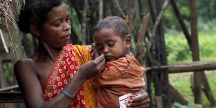 Malnutrition among kids on rise in Mayurbhanj