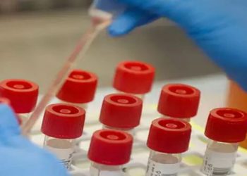 Triple Antigen Test