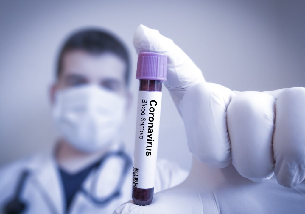 Coronavirus: Over 57L COVID cases, above 91K deaths in India