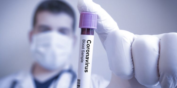 Coronavirus: Over 57L COVID cases, above 91K deaths in India