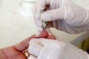 Blood Test