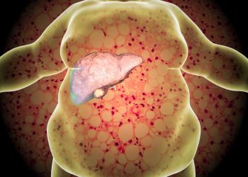 Researchers develop sensor to detect fatty liver disease
