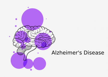 This could be an early sign of Alzheimer's