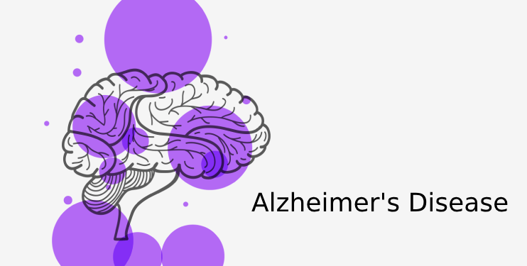 This could be an early sign of Alzheimer's