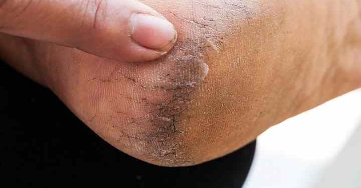 Pic Credit: girliciousbeauty.com