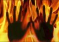 burnt alive