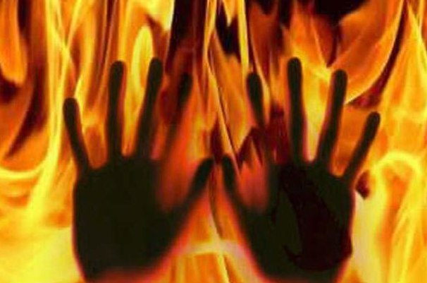 Woman sets minor son on fire, dies after self-immolation bid in Jagatsinghpur district
